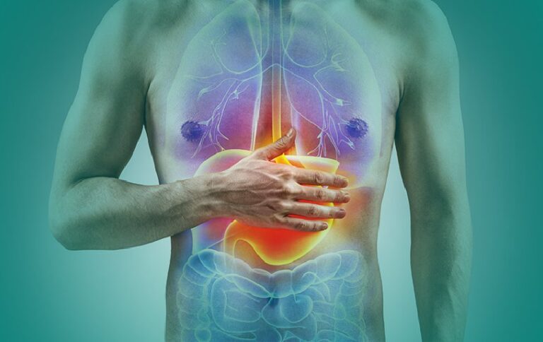 Home Remedies to get rid of Acidity