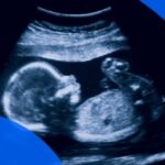 shocking 55 minor pregnant girl scanning took place