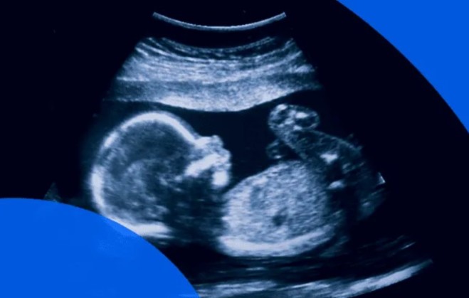shocking 55 minor pregnant girl scanning took place