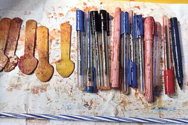 33 Year Old Woman Stomach Yields Pens Wooden Spoons and Candle