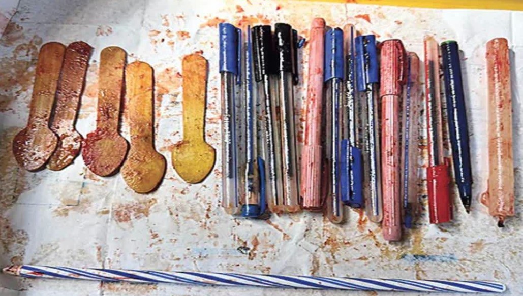 33 Year Old Woman Stomach Yields Pens Wooden Spoons and Candle